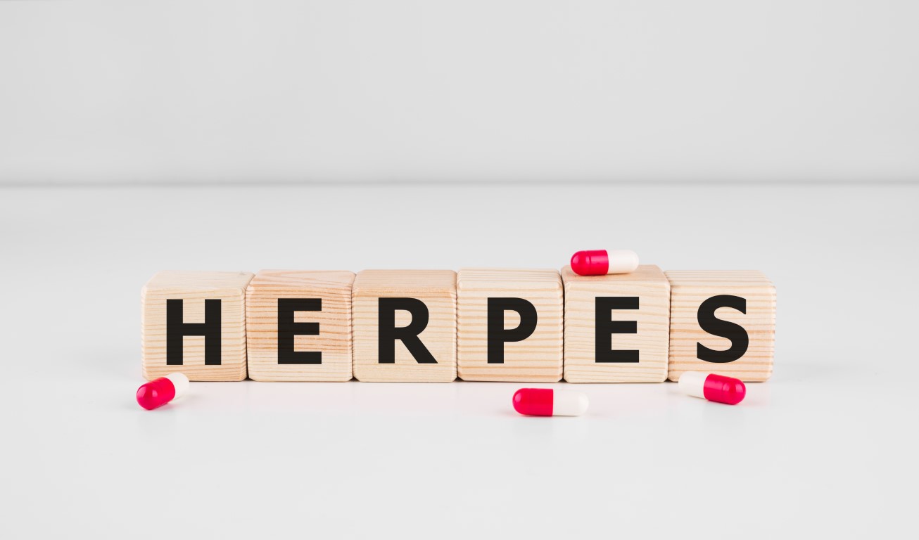simptome herpes